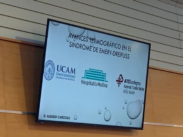 Termografía en el diagnóstico de Enfermedades Raras - 1, Foto 1