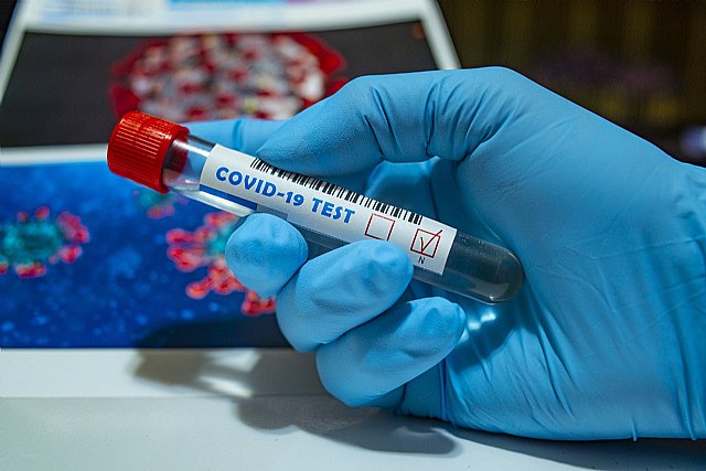 El Instituto de Salud Carlos III homologa a la UMU como laboratorio para hacer pruebas PCR de diagnóstico del coronavirus - 1, Foto 1