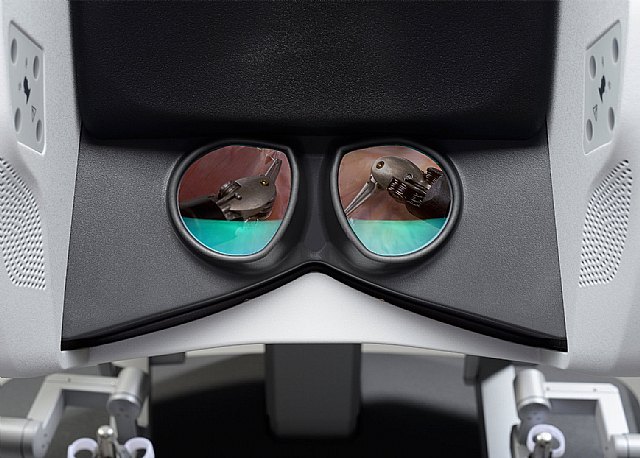 El Hospital del Guadalentín, primer centro privado de la Región en incorporar la cirugía robótica Da Vinci - 1, Foto 1