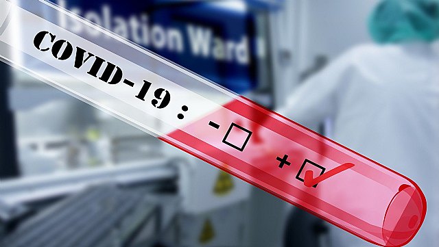 La SEORL-CCC recomienda incluir las alteraciones de olfato y gusto y el dolor de garganta como sospecha de COVID-19 - 1, Foto 1