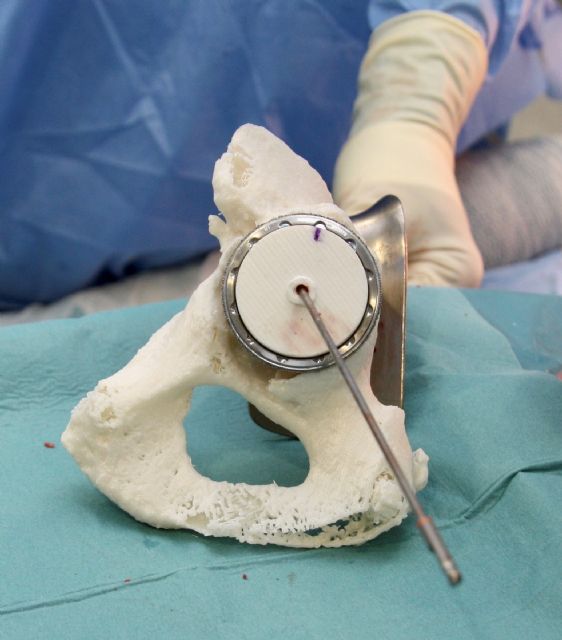 HLA La Vega realiza la primera intervención de cadera digitalizada - 2, Foto 2