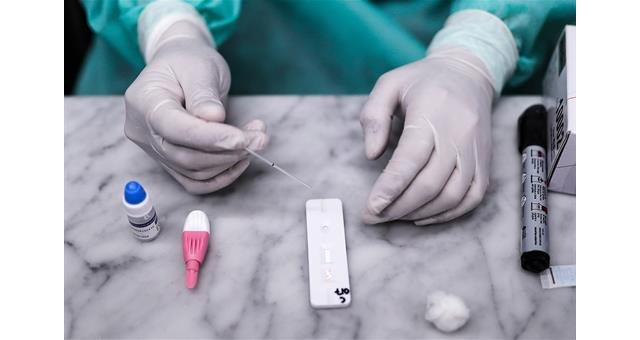 El Gobierno distribuye más de 750.000 test rápidos de detección de anticuerpos entre las comunidades autónomas - 1, Foto 1