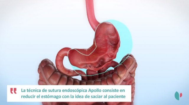 Que la obesidad no te amargue la vida, Aula de Salud de Policlínica Gipuzkoa el jueves en San Sebastián - 1, Foto 1