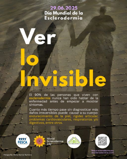 El Ayuntamiento de Lorca ilumina de verde la pasarela 'Alcalde Miguel Navarro Molina' y la fuente de San Antonio por el Día Mundial de la Esclerodermia - 1, Foto 1