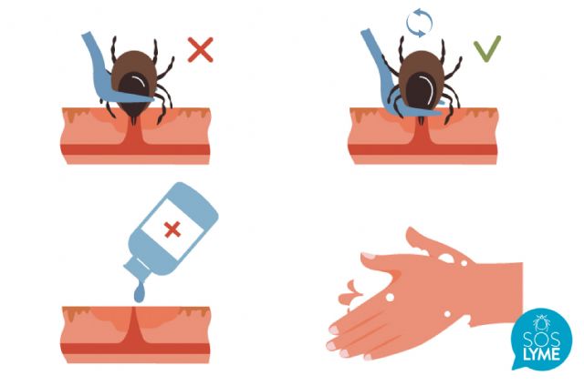 Advierten del aumento de las picaduras de garrapatas - 1, Foto 1