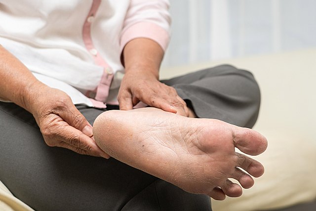 El 90% de los mayores de 65 años padecen problemas en los pies - 1, Foto 1