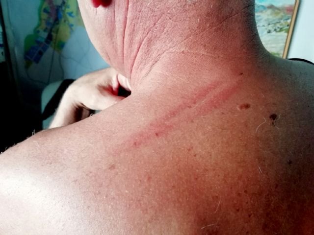 Los Yay@flautas de Murcia condenan enérgicamente agresión física sufrida por Pedro Sosa - 2, Foto 2