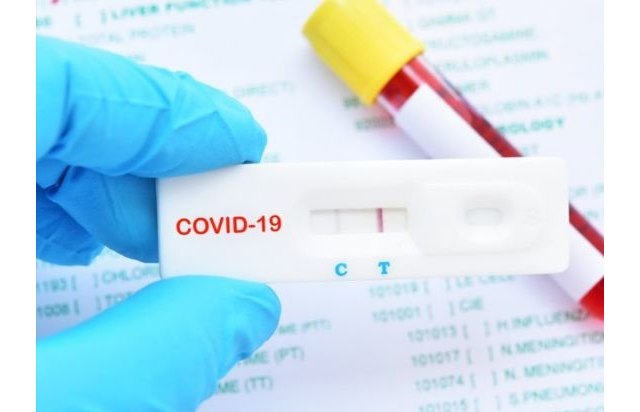 El PP preguntará en el pleno sobre la realización de test masivos a los vecinos para la detección precoz del COVID-19 - 1, Foto 1