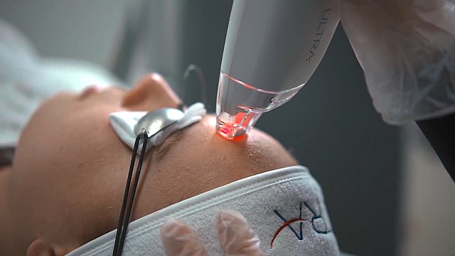 Seriderm lanza un programa de cuidado de la piel que mejora en un 70% la efectividad de los tratamientos láser estéticos - 1, Foto 1