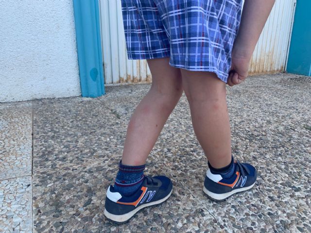 La inacción del PSOE desata las quejas vecinales por la multiplicación descontrolada del mosquito tigre - 1, Foto 1