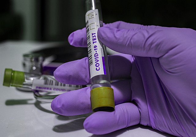 La Región de Murcia ha registrado 352 nuevos contagios por coronavirus, 11 en Totana, Foto 1