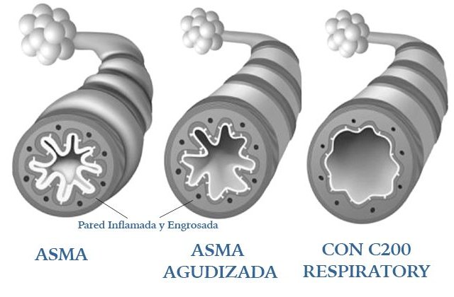Una empresa española presenta una innovación para el tratamiento de ahogo e inflamación de los pulmones - 1, Foto 1