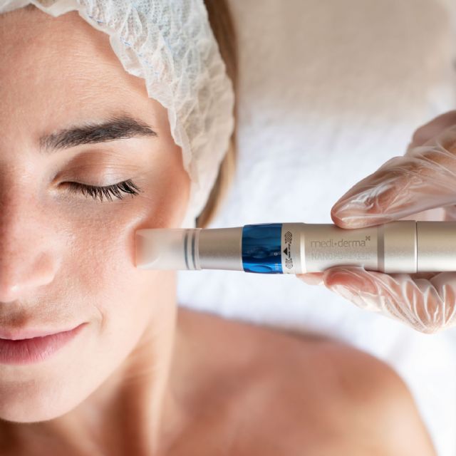 Mediderma potencia en Europa su innovador sistema de micropunción, Nanopore Pen - 2, Foto 2