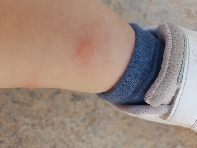 El PP alerta de plagas de pulgas y garrapatas en la pedanía de Calabardina así como en otros  puntos de Águilas - 1, Foto 1