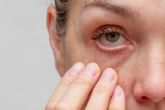 Claves para aliviar el sndrome del ojo seco