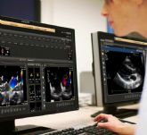 Murcia implanta una solucin que mejora el diagnstico y el tratamiento del paciente cardaco
