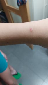 El PP propone que se incremente el nmero de fumigaciones ante los continuos problemas generados por nubes de insectos en todo el municipio