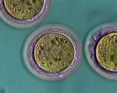 Investigadores de la UMU y el IMIB descubren una proteína del espermatozoide esencial para que ocurra la fecundación