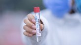 Servicio de Epidemiolog�a confirma 13 nuevos casos positivos de por Covid-19 en Totana