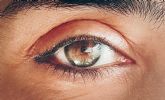12 de marzo. Día Mundial del Glaucoma Las preocupantes cifras del Glaucoma en Murcia