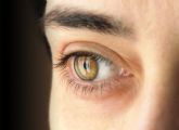 12 de marzo. Día Mundial del Glaucoma Alrededor de 33.000 personas sufren Glaucoma en Murcia