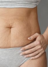 Fuera el vello y las estr�as: la opci�n l�ser perfecta, incluso en verano