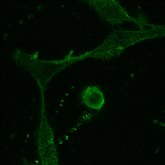 Laminar Pharma supera el 50% de pacientes reclutados en su ensayo del LAM561