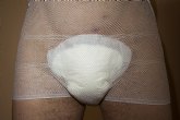 Una tcnica libera del uso de pañales al 80% de los hombres con incontinencia urinaria, una consecuencia del cncer de prstata