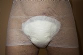 Una tcnica libera del uso de pañales al 80% de los hombres con incontinencia urinaria, una consecuencia del cncer de prstata