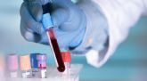 Blueberry Diagnostics lanza el primer test basado en un análisis de sangre para el diagnóstico de COVID-19