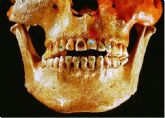 Breve repaso a la historia de la Odontologa con la Clnica Dental Urbina en Salamanca