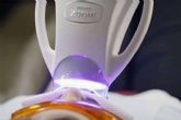 El blanqueamiento dental en casa refuerza los resultados del procedimiento cl�nico