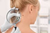 Eliminaci�n de verrugas y lunares con tecnolog�a de vanguardia en el Centro M�dico El Pilar