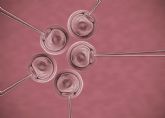 La activacin asistida de los vulos mejora la calidad de los embriones en mujeres de edad avanzada, segn una tcnica del Dr. Jan Tesarik