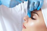 Dr. Luigi Grossi realiza la rinoplastia sin cirug�a y con resultados exitosos
