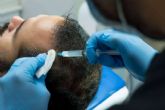 Kuntur Clinic, una cl�nica de injerto capilar en Barcelona