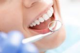 ?En qu� consiste el blanqueamiento dental?, por Bucalia