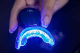Tratamiento de blanqueamiento dental LED, de la mano de la Clnica MG Dental & Esttica Facial