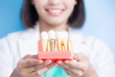 Los tipos de implantes dentales que existen y cul usar segn las necesidades, por DeltaDent