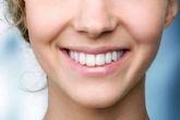 Cuidado de los dientes despu�s de un blanqueamiento dental