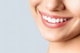 Aplicación de carillas dentales en la clínica experta de Carlos Saiz Smile