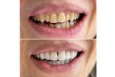 En Cl�nica MG Dental son expertos en est�tica dental