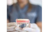 Especialistas en implantes dentales, Cl�nica MG Dental