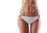 A2Clinic, especialistas en abdominoplastias en Barcelona