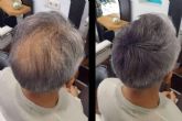 Espana es el segundo pa�s del mundo con mayor tasa de p�rdida de pelo, Lion Hair explica la situaci�n