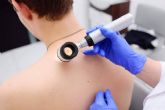 Buenos h�bitos al sol como medida de protecci�n ante los melanomas