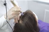 Tratar la alopecia femenina con el tratamiento bioestimulación de IMD Instituto Médico Dermatológico