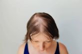 Alopecia femenina. ¿Cómo detectarla y qué tratamientos son los adecuados?