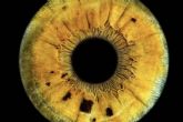 Perfil psicológico sano de los pacientes que llevan a cabo el láser de cambio de color de ojos