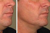 La Cl�nica Calvo de Mora es una cl�nica maxilofacial especializada en cirug�as ortogn�ticas